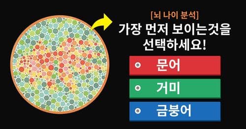 [뇌 나이 분석] 과연 당신의 뇌는 몇살일까요?